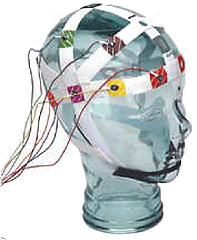 Cadwell 10/20 BraiNet EEG Electrode Template